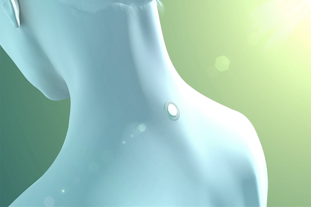 patchPlacement-1024x683-1